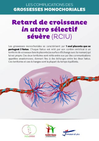 https://assoafgm.fr/wp-content/uploads/2022/11/Plaquette_RCIU-320x453.jpg