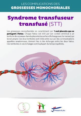 https://assoafgm.fr/wp-content/uploads/2022/11/Plaquette_STT-320x453.jpg