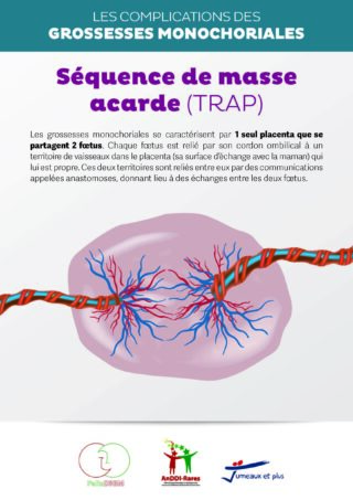 https://assoafgm.fr/wp-content/uploads/2022/11/Plaquette_TRAP-320x453.jpg